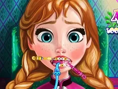 Frozen  Games, Anna Dentist, Games-kids.com