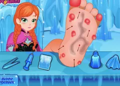 Frozen  Games, Anna Foot Doctor, Games-kids.com