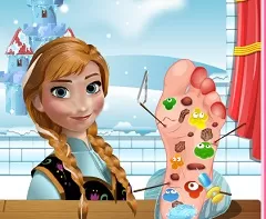 Frozen  Games, Anna Foot Injury, Games-kids.com