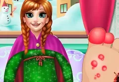 Frozen  Games, Anna Foot Injury 2, Games-kids.com