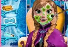 Frozen  Games, Anna Makeover, Games-kids.com