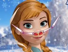 Frozen  Games, Anna Nose Problem, Games-kids.com