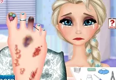 Frozen  Games, Elsa Foot Doctor, Games-kids.com