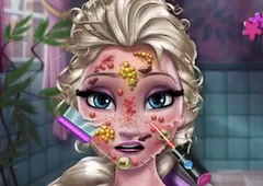 Frozen  Games, Elsa Skin Doctor, Games-kids.com