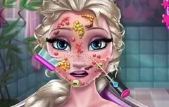 Frozen  Games, Ice Queen Skin Doctor, Games-kids.com