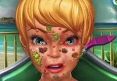 Tinkerbell Games, Pixie Skin Doctor, Games-kids.com