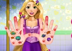 Rapunzel Games, Rapunzel Hand Treatment, Games-kids.com